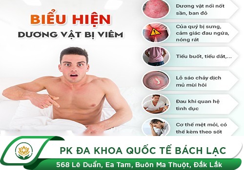 Nỗi Ám Ảnh Mang Tên Viêm Dương Vật Ở Nam Giới