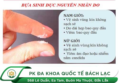 Nguyên nhân gây nên bựa sinh dục