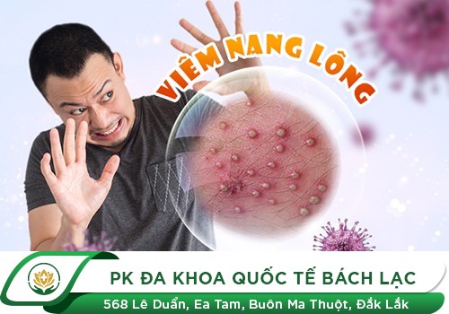 Bệnh nổi mụn ở bộ phận sinh dục nam