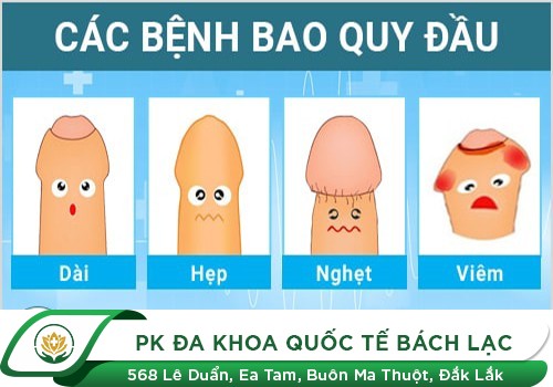 Những bệnh lý thường gặp tại rãnh quy đầu