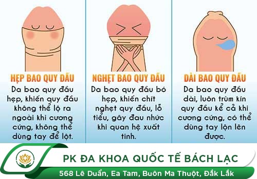Các bệnh bao quy đầu bẩm sinh: 