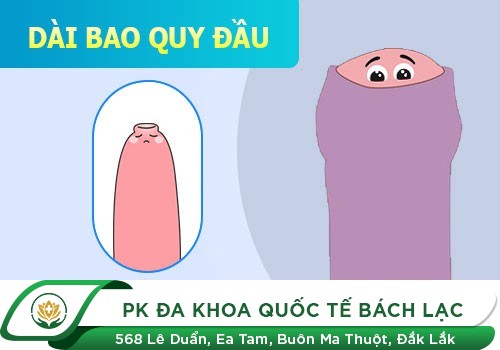 Một số hình ảnh dài bao quy đầu ở nam giới