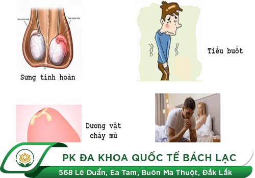 Đau dương vật khi quan hệ là dấu hiệu bệnh gì?