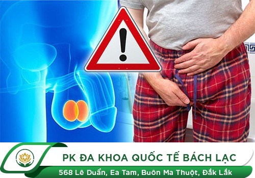 Dấu hiệu sưng bùng bìu ở nam giới