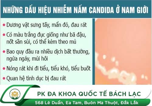 Nam giới và dấu hiệu mắc bệnh nấm Candida?