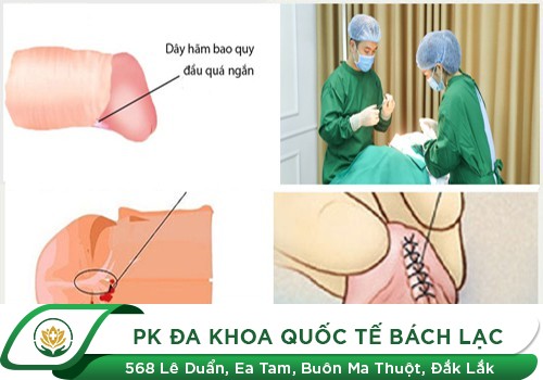 Nguyên nhân chảy máu dương vật sau khi quan hệ