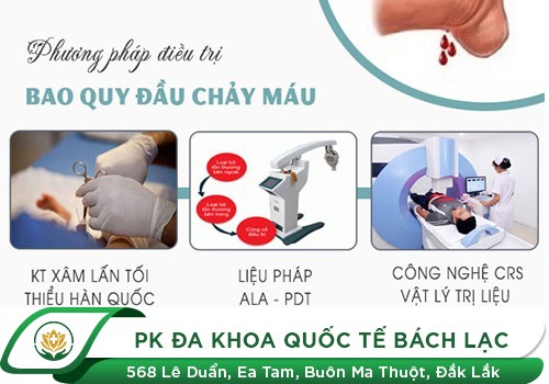 Điều trị bao quy đầu chảy máu nhanh chóng
