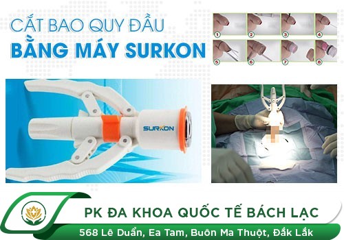 CẮT BAO QUY ĐẦU BẰNG CÁCH NÀO HIỆU QUẢ, AN TOÀN?