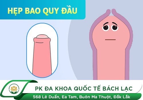 Hẹp Bao Quy Đầu Có Quan Hệ Được Không