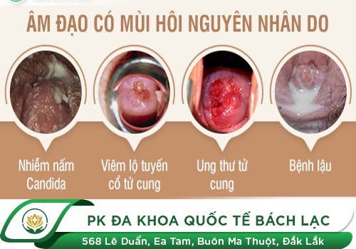 Biểu hiện tố cáo tình trạng hôi vùng kín ở nam và nữ