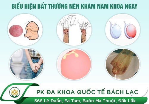 Loại xét nghiệm bệnh nam khoa nam giới không thể bỏ qua