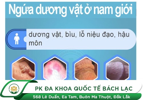 Ngứa Đầu Dương Vật - Triệu Chứng Nam Giới Không Nên Bỏ Qua