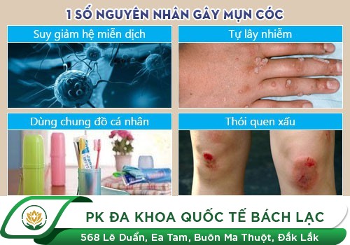 Những bệnh da liễu nguy hiểm thường gặp ở nam giới