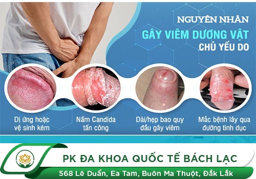 1 số hình ảnh dấu hiệu bệnh viêm dương vật ở nam giới?