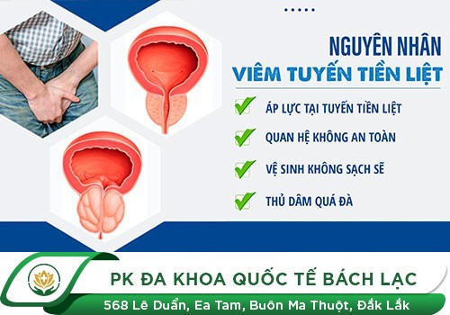 Nên Chữa Viêm Tuyến Tiền Liệt Như Thế Nào