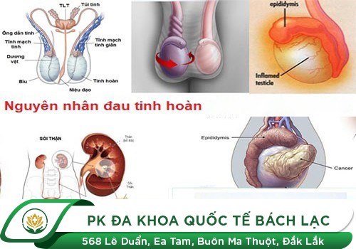 Nguyên nhân gây đau 1 bên tinh hoàn