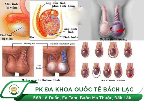  đau tinh hoàn 1 bên, đau 2 bên có nguy hiểm gì không?  