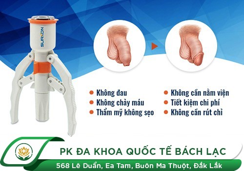 Cắt bao quy đầu - giải quyết cậu nhỏ mắc bệnh khó nói