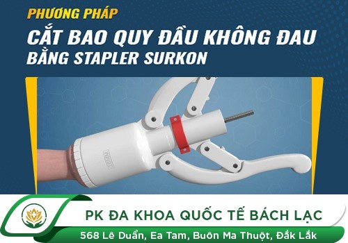 Cắt bao quy đầu bằng kỹ thuật xâm lấn tối thiểu của Hàn Quốc