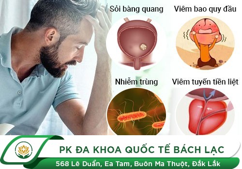 Những Cơn Đau Dương Vật Ở Nam Giới Báo Hiệu Điều Gì