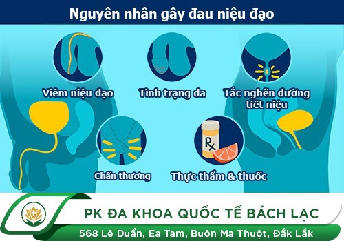 Đau niệu đạo là biểu hiện của bệnh gì?