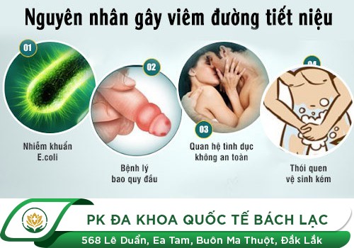 Liệu Pháp Chữa Viêm Đường Tiết Niệu Hiện Đại Cho Nam Giới