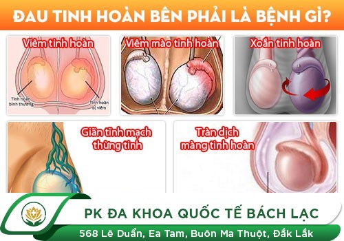 nguyên nhân gây ra những cơn đau tại tinh hoàn phải
