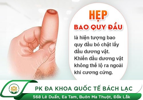 Những Cách Chữa Trị Hẹp Bao Quy Đầu Không Đau Mau Lành