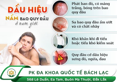 Khi dương vật có nhiều bựa trắng có mùi hôi là dấu hiệu của bệnh gì?