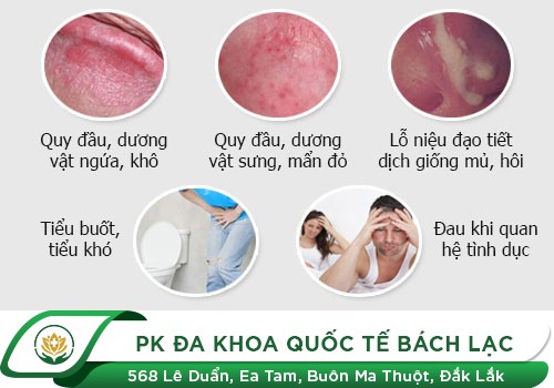 Bệnh nấm vùng bìu do nấm Candida