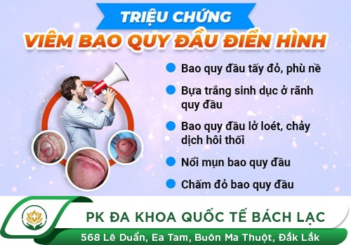 Viêm bao quy đầu là nguyên nhân hàng đầu khiến dương vật - bộ phận sinh dục nam giới chảy mủ