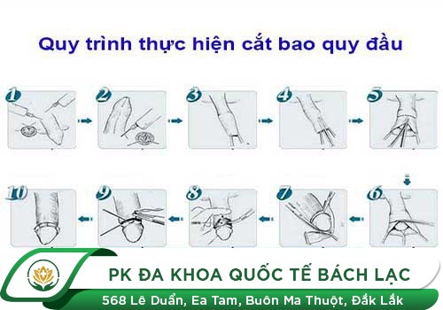 Quy trình cắt bao quy đầu diễn ra thế nào?