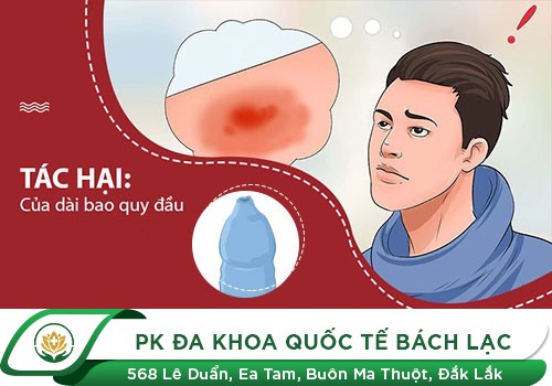 DÀI BAO QUY ĐẦU CÓ NÊN CẮT KHÔNG?