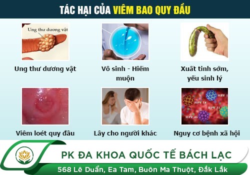 ẢNH HƯỞNG CỦA SƯNG BAO QUY ĐẦU