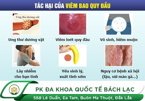NỔI MẨN ĐỎ QUANH BAO QUY ĐẦU LÀ DẤU HIỆU CỦA BỆNH GÌ?