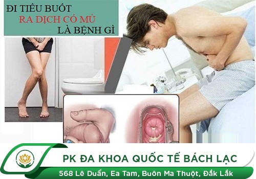 Đi Tiểu Bị Buốt Đường Tiểu, Tại Sao