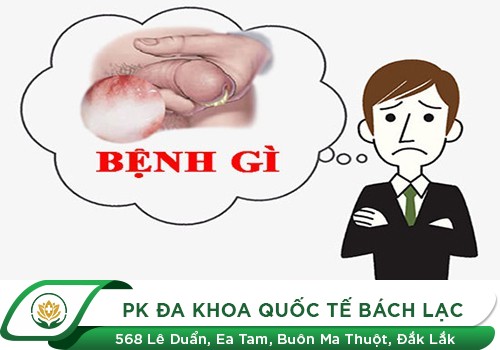 Tiểu buốt, tiểu rắt, tiểu có mủ
