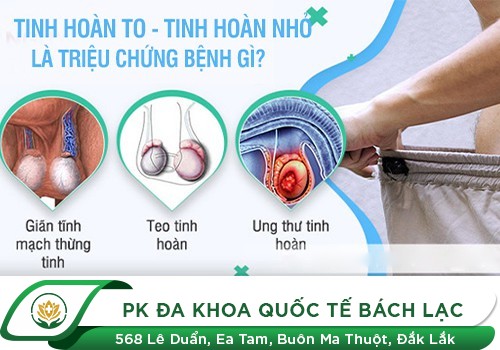 Nam giới bị teo tinh hoàn do đâu?