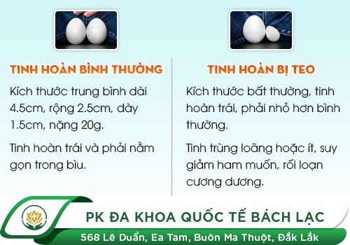 Làm sao nhận biết tinh hoàn bị teo