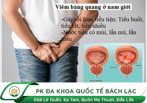 Viêm bàng quang