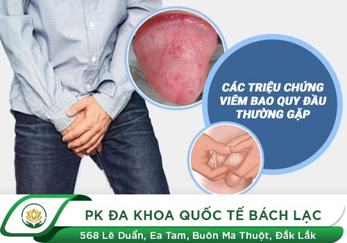 NGỨA BAO QUY ĐẦU LÀ DO BỆNH GÌ GÂY RA?