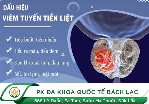 Viêm tuyến tiền liệt