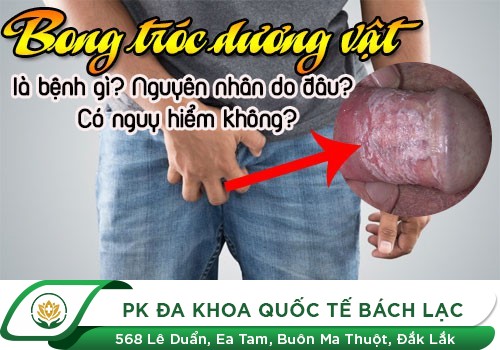 Tình trạng bao quy đầu bị bong tróc da và nguyên nhân gây ra