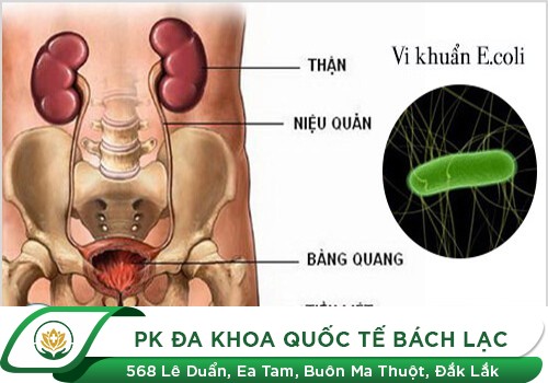 Dấu hiệu tiểu đêm cảnh báo bệnh gì?