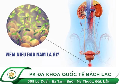 Nguyên nhân gây viêm niệu đạo ở nam giới: