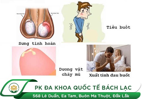 Xuất Tinh Đau Buốt - Những Điều Nam Giới Nên Biết