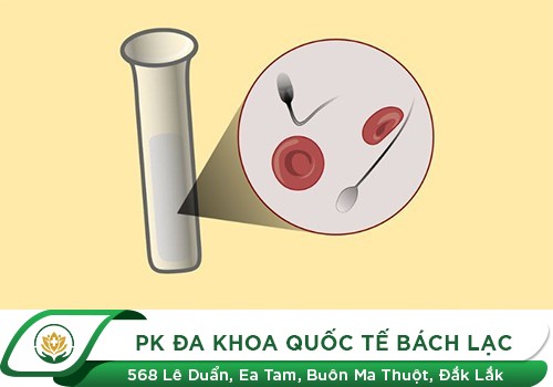 Hiện tượng xuất tinh muộn ở nam giới là gì?