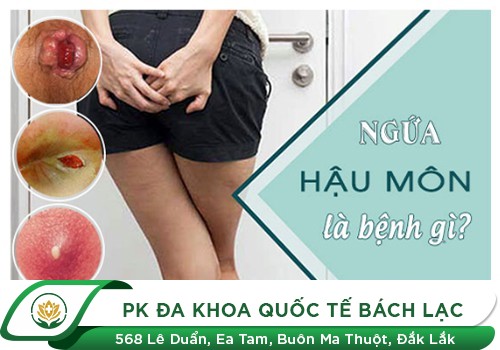 Ngứa Hậu Môn Là Bị Bệnh Gì, Có Sao Không