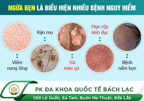 Ngứa Bộ Phận Sinh Dục Nam Giới Trị Như Thế Nào?