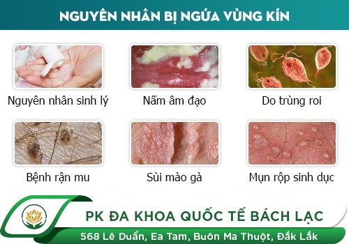 Nguyên Nhân Gây Ngứa Bộ Phận Sinh Dục